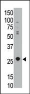 Apolipoprotein B MRNA Editing Enzyme Catalytic Subunit 3A antibody, AP11346PU-N, Origene, Western Blot image 