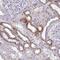 Ribonuclease H1 antibody, PA5-60209, Invitrogen Antibodies, Immunohistochemistry frozen image 