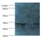 Meteorin Like, Glial Cell Differentiation Regulator antibody, LS-C371526, Lifespan Biosciences, Western Blot image 