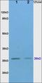 TIMP Metallopeptidase Inhibitor 1 antibody, orb313247, Biorbyt, Western Blot image 