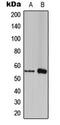 Forkhead Box C1 antibody, MBS8218539, MyBioSource, Western Blot image 