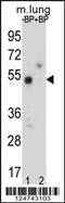 TOX High Mobility Group Box Family Member 3 antibody, 61-675, ProSci, Western Blot image 