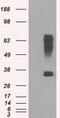 Ring Finger Protein 144B antibody, GTX83705, GeneTex, Western Blot image 