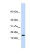 HECT And RLD Domain Containing E3 Ubiquitin Protein Ligase 4 antibody, NBP1-53020, Novus Biologicals, Western Blot image 