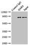 Glutaminyl-TRNA Synthetase antibody, LS-C376415, Lifespan Biosciences, Immunoprecipitation image 