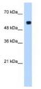 Poly(U) Binding Splicing Factor 60 antibody, NBP1-57427, Novus Biologicals, Western Blot image 