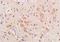 Transmembrane Protein 158 (Gene/Pseudogene) antibody, orb158619, Biorbyt, Immunohistochemistry paraffin image 