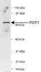 Protection Of Telomeres 1 antibody, NB500-176, Novus Biologicals, Western Blot image 