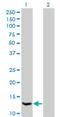 TRNA Methyltransferase Subunit 11-2 antibody, H00051504-M09, Novus Biologicals, Western Blot image 