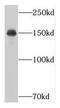 Nucleoporin 160 antibody, FNab05922, FineTest, Western Blot image 