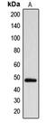 Arrestin Domain Containing 1 antibody, LS-C353605, Lifespan Biosciences, Western Blot image 