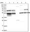 Centrosomal Protein 57 Like 1 antibody, NBP1-88761, Novus Biologicals, Western Blot image 