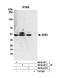 SDS3 Homolog, SIN3A Corepressor Complex Component antibody, NB100-257, Novus Biologicals, Western Blot image 