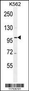 DEAD-Box Helicase 27 antibody, 55-630, ProSci, Western Blot image 