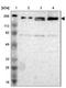 DNA Polymerase Alpha 1, Catalytic Subunit antibody, NBP1-82449, Novus Biologicals, Western Blot image 