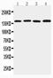 Tight Junction Protein 2 antibody, PA1971, Boster Biological Technology, Western Blot image 