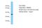 Transmembrane Protein 26 antibody, A13118, Boster Biological Technology, Western Blot image 