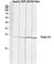 Putative teratocarcinoma-derived growth factor 2 antibody, A15317, Boster Biological Technology, Western Blot image 