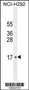 LLP Homolog, Long-Term Synaptic Facilitation Factor antibody, 55-461, ProSci, Western Blot image 