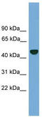 Proteasome 26S Subunit, Non-ATPase 12 antibody, TA344575, Origene, Western Blot image 