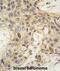 Angel Homolog 2 antibody, abx031686, Abbexa, Immunohistochemistry paraffin image 