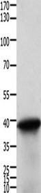 Tropomyosin 2 antibody, TA321952, Origene, Western Blot image 