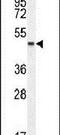 Leucine Rich Repeat Containing 34 antibody, PA5-24101, Invitrogen Antibodies, Western Blot image 