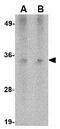 HCLS1 Associated Protein X-1 antibody, GTX84982, GeneTex, Western Blot image 
