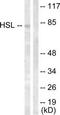 Lipase E, Hormone Sensitive Type antibody, TA312899, Origene, Western Blot image 