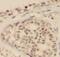 PCNA antibody, FNab06217, FineTest, Immunohistochemistry paraffin image 