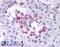MAGE Family Member A3 antibody, LS-B884, Lifespan Biosciences, Immunohistochemistry frozen image 