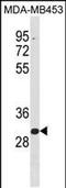 Zinc Finger Protein 367 antibody, PA5-49261, Invitrogen Antibodies, Western Blot image 