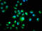 Casein Kinase 1 Epsilon antibody, LS-C369930, Lifespan Biosciences, Immunofluorescence image 