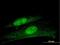 Ankyrin Repeat Domain 7 antibody, H00056311-B01P, Novus Biologicals, Immunocytochemistry image 