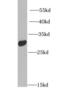 Insulin Like Growth Factor Binding Protein 5 antibody, FNab04180, FineTest, Western Blot image 