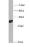 Insulin-like growth factor-binding protein 5 antibody, FNab04180, FineTest, Western Blot image 