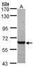 Chaperonin Containing TCP1 Subunit 5 antibody, LS-C186111, Lifespan Biosciences, Western Blot image 