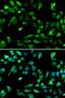 SATB Homeobox 1 antibody, LS-C334301, Lifespan Biosciences, Immunofluorescence image 