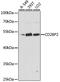 CD2 Cytoplasmic Tail Binding Protein 2 antibody, A15777, ABclonal Technology, Western Blot image 