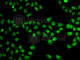 Staphylococcal Nuclease And Tudor Domain Containing 1 antibody, A5874, ABclonal Technology, Immunofluorescence image 