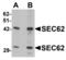 SEC62 Homolog, Preprotein Translocation Factor antibody, A05906, Boster Biological Technology, Western Blot image 