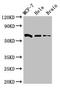 Shugoshin-like 1 antibody, LS-C679447, Lifespan Biosciences, Western Blot image 