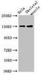 Period Circadian Regulator 3 antibody, LS-C678986, Lifespan Biosciences, Western Blot image 
