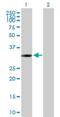 Inositol-Tetrakisphosphate 1-Kinase antibody, H00003705-B01P, Novus Biologicals, Western Blot image 