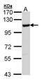 Heat Shock Protein Family A (Hsp70) Member 4 antibody, GTX112329, GeneTex, Western Blot image 