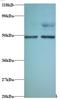 Eukaryotic Translation Initiation Factor 4A2 antibody, LS-C212123, Lifespan Biosciences, Western Blot image 