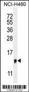 Transmembrane protein 100 antibody, MBS9212673, MyBioSource, Western Blot image 