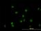GATA Binding Protein 2 antibody, H00002624-M04, Novus Biologicals, Immunocytochemistry image 