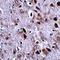 Transmembrane Protein 18 antibody, orb75148, Biorbyt, Immunohistochemistry paraffin image 