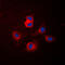 Cytochrome P450 Family 17 Subfamily A Member 1 antibody, GTX56294, GeneTex, Immunofluorescence image 